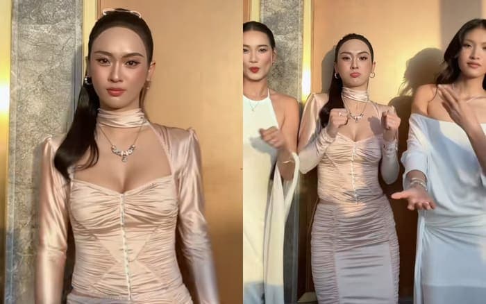 Đường chân tóc có phần lạ lẫm của Vũ Thúy Quỳnh trở nên nổi bật khi xuất hiện ở khu vực có nhiều ánh sáng. Ảnh chụp màn hình