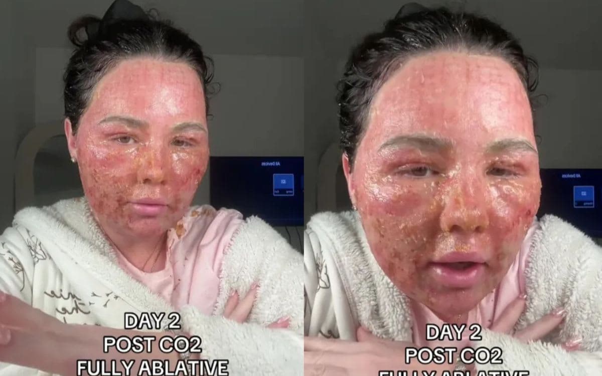 Sau khi làm đẹp, người phụ nữ rơi vào tình cảnh 'rùng mình'